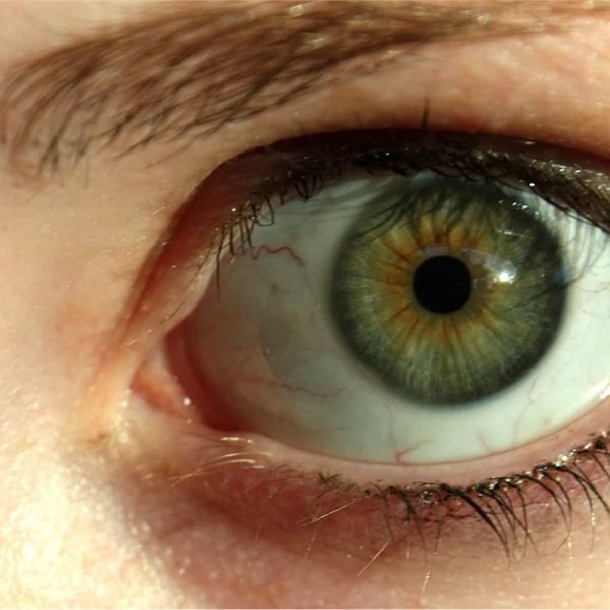 Inwoner gebrek herten Why Do Some People Have Dark Rings Around the Iris of Their Eye? - Bellatory