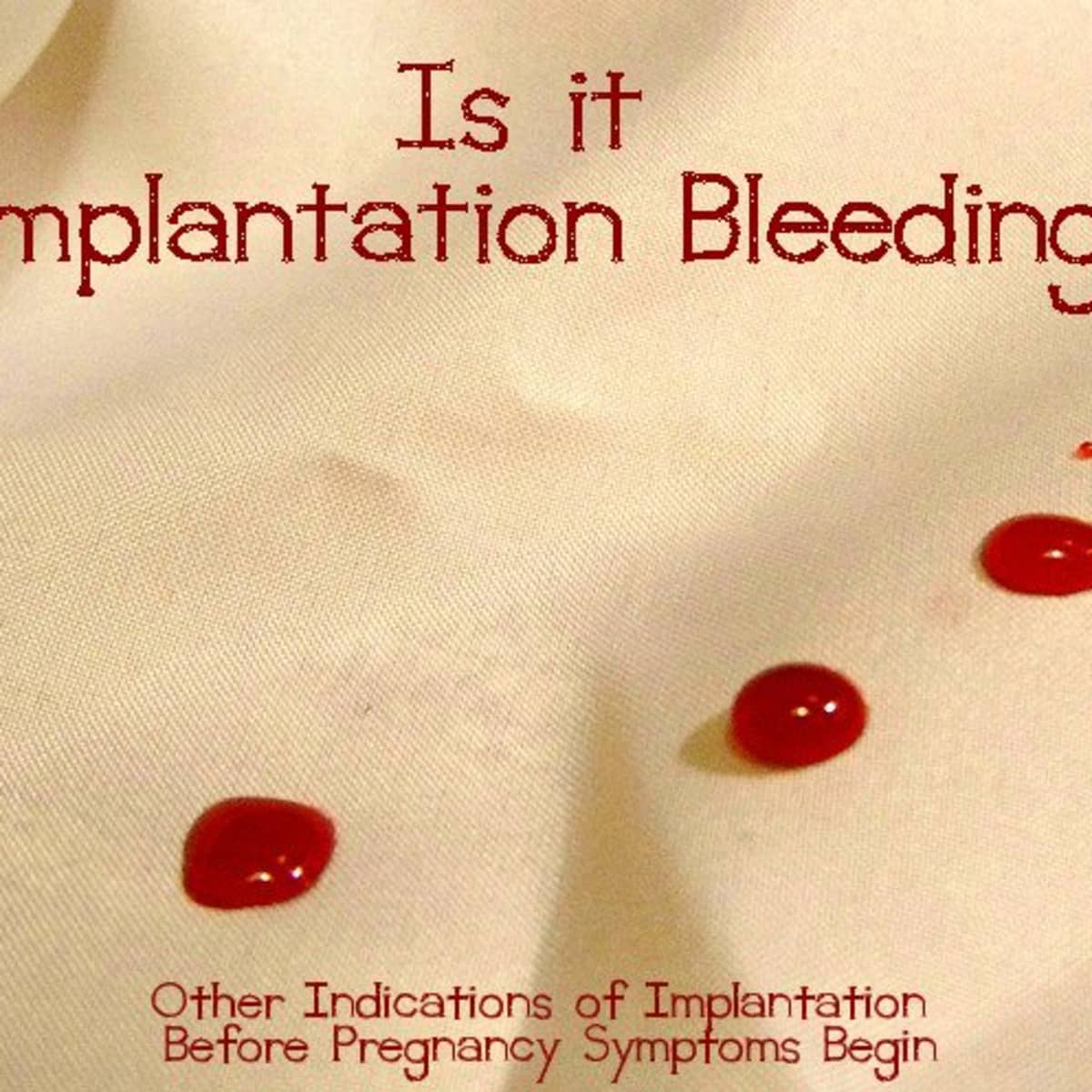 Incredible Collection Of Full 4K Implantation Bleeding Images Over 