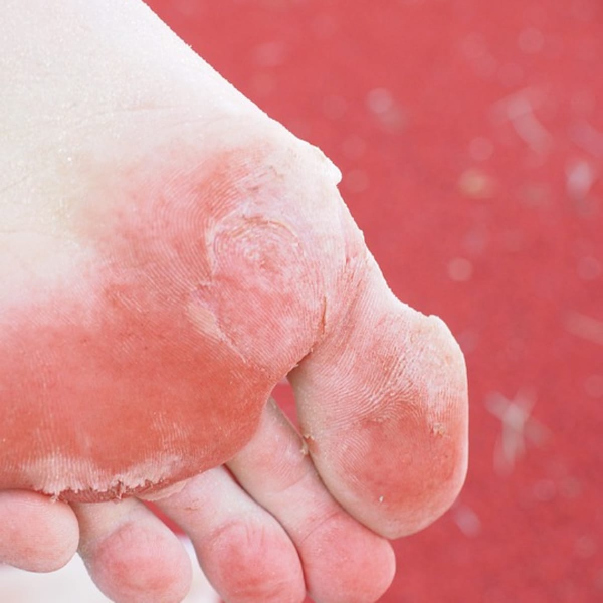 Remedies for Stinky Sandals - Synonym