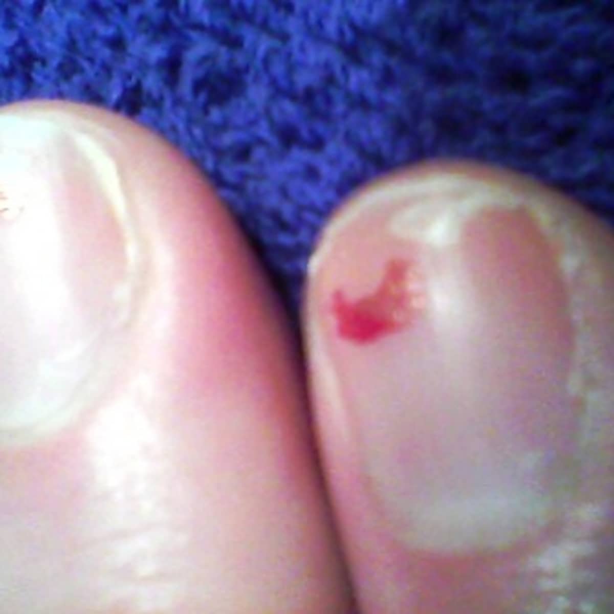 Nail Hardeners For Brittle Nails - HubPages