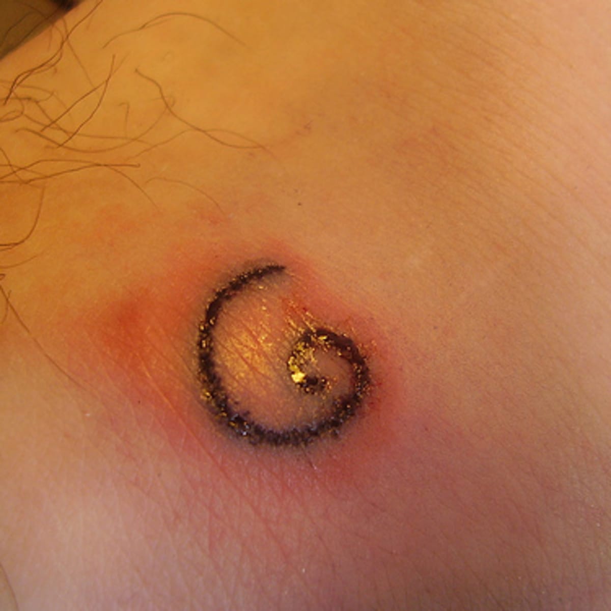 Post-infection cracked and bleeding mess - Initiation - Last Sparrow Tattoo