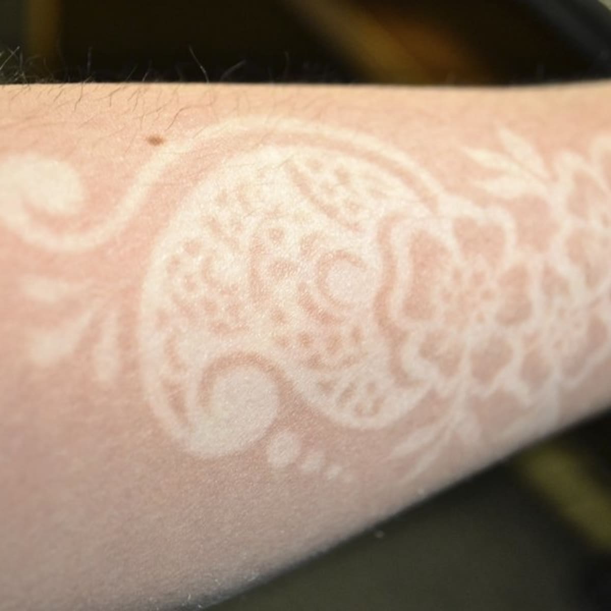 Pain and scarring: Warning over chemical filled black henna tattoos | UK  News | Sky News