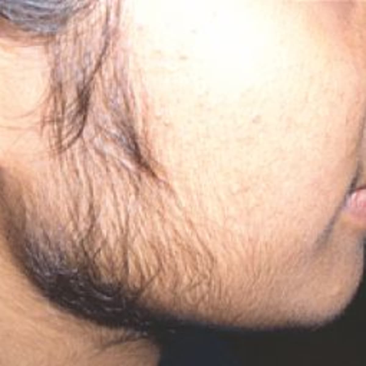 Women's Facial Hair Removal - HubPages