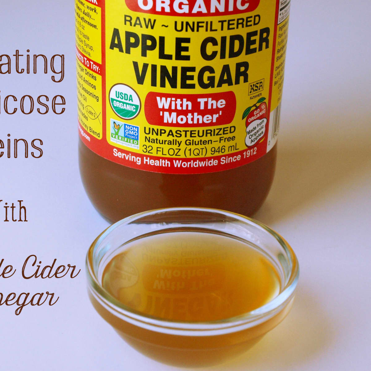 Get Rid of Varicose Veins with Apple Cider Vinegar Treatment