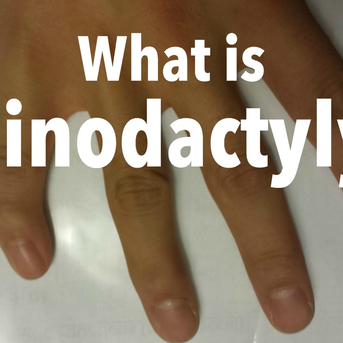 Hand of Benediction: What Is It, Causes, and More | Osmosis