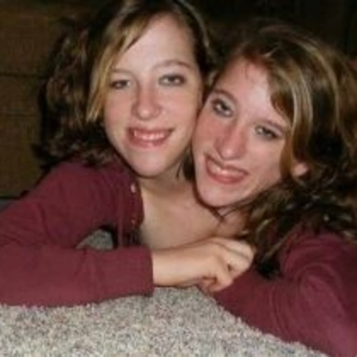 The Amazing Lives of Abby and Brittany Hensel - HubPages