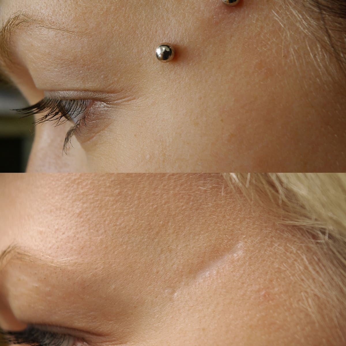 different types of dermal piercings