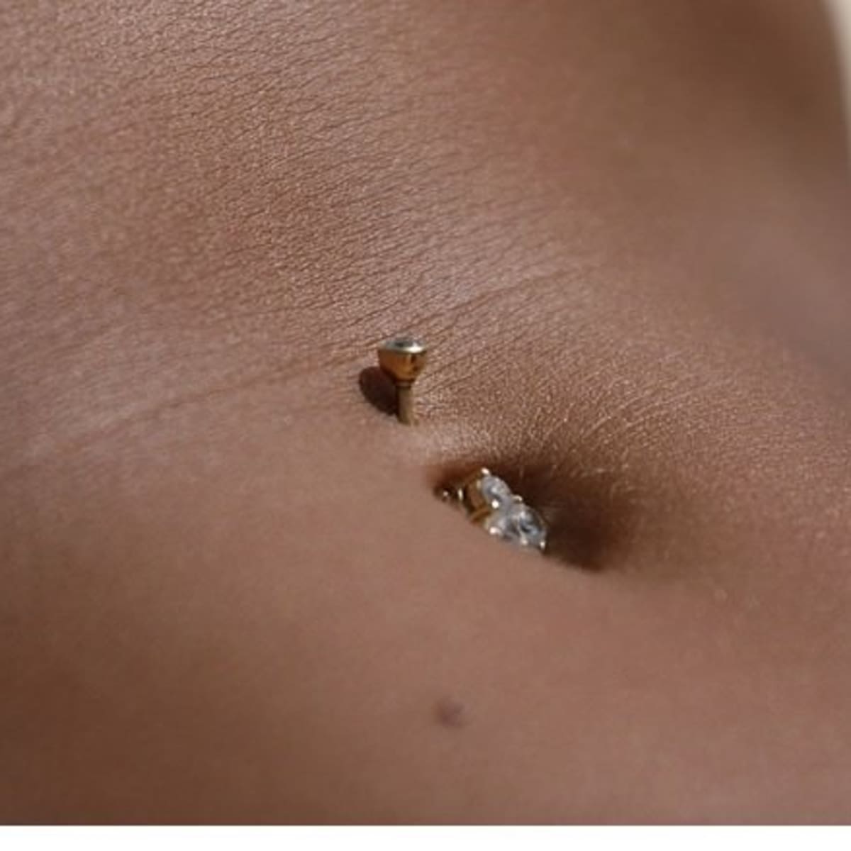 My Prolonged Belly Button Piercing Nightmare picture