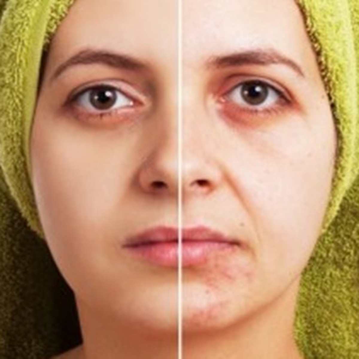 fade cream for face