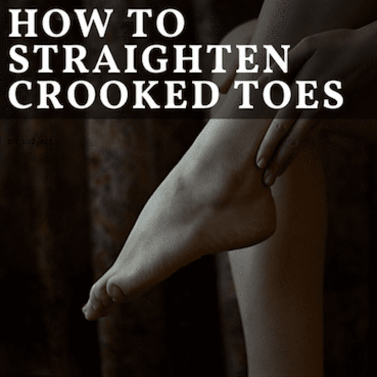 How to Straighten Crooked Toes Without Surgery - RemedyGrove