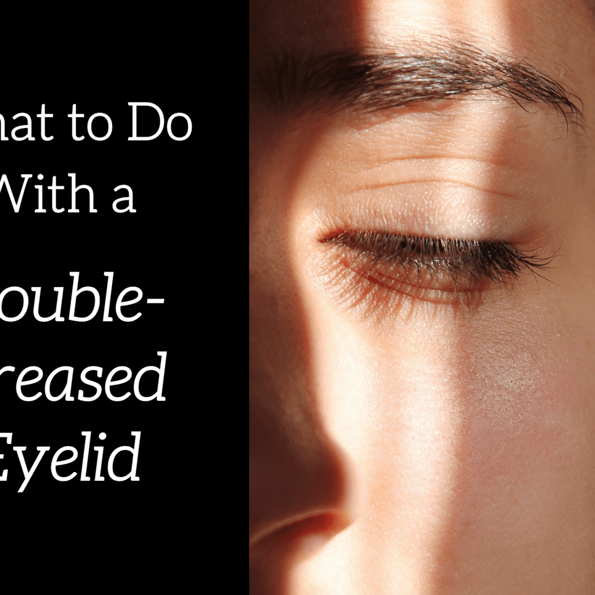 How To Get Rid Of Double Eyelid Documentride5