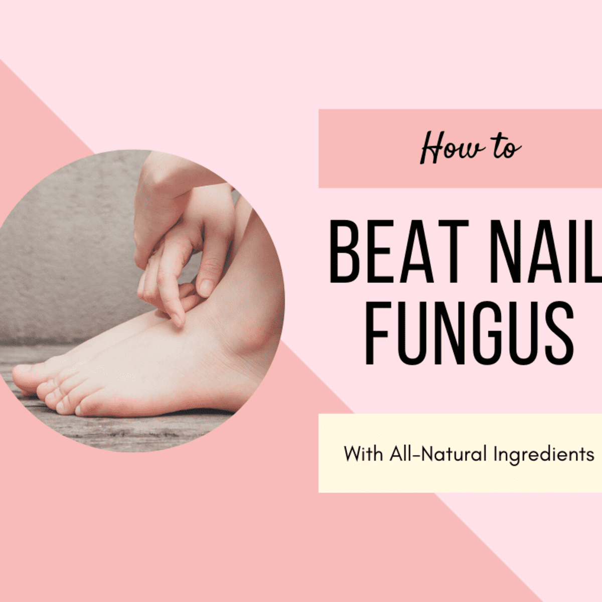 10 Natural Remedies to Get Rid of Nail Fungus - Bellatory
