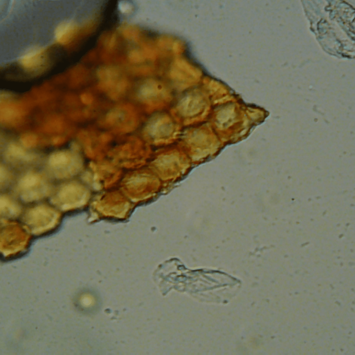 microorganisms under microscope
