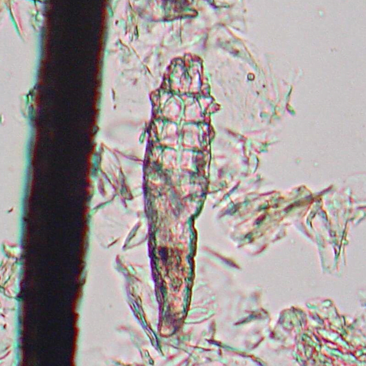 Demodex store canis mites