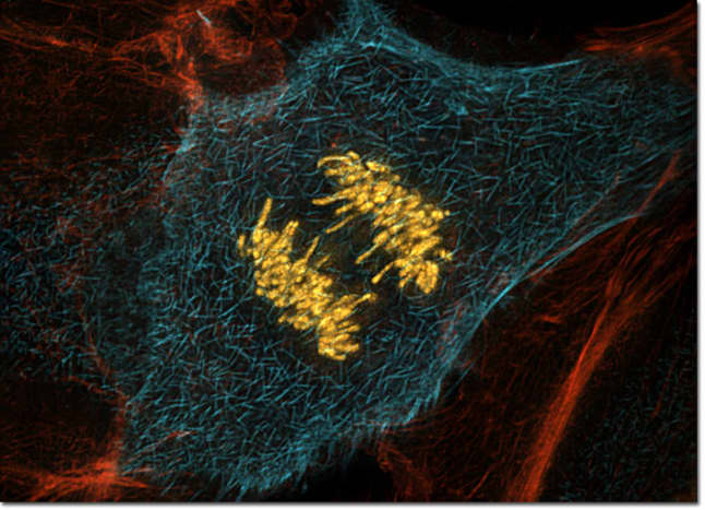 A fake colour image micrograph of a dividing cell in Anaphase