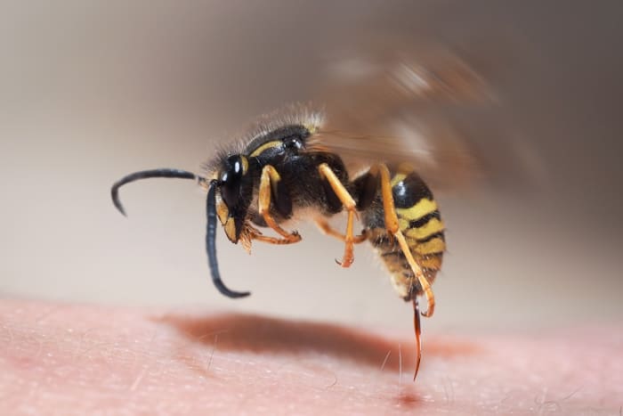 As you can see, this yellowjacket has already stung this person and its stinger is still intact.  They are capable of stinking many times, unlike the honey bee, which dies after the first (and only time) it stings.