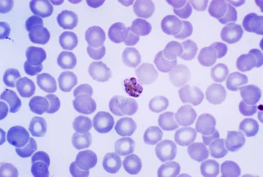 This photomicrograph shows a mature Plasmodium malariae schizont within an infected RBC. This mature P. malariae schizont is contained within a normal sized RBC. 