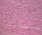 Smooth Muscle H&amp;E Stain