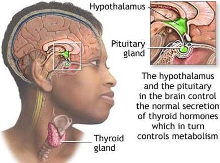 thyrotoxicosis-personal-experiences-of-living-with-thyroid-problems
