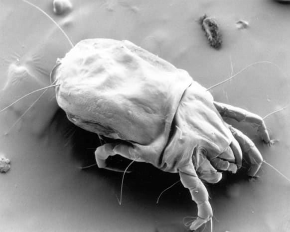 One House Dust Mite under a microscope.