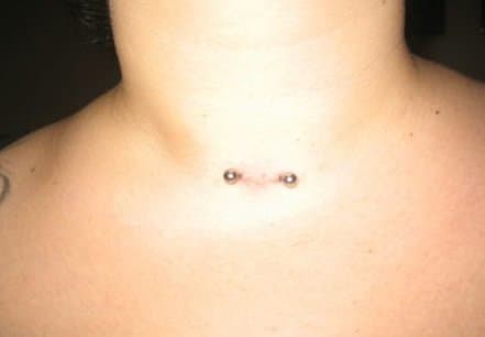 A Typical Neck Piercing