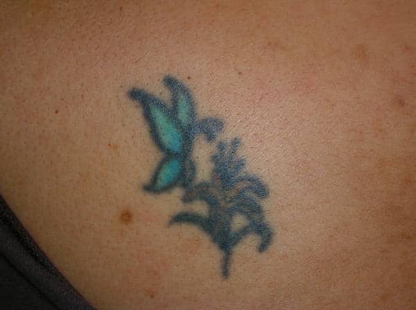 Butterfly (before): I happen to think this is a cute tattoo. But it is definitely faded and blurry. 