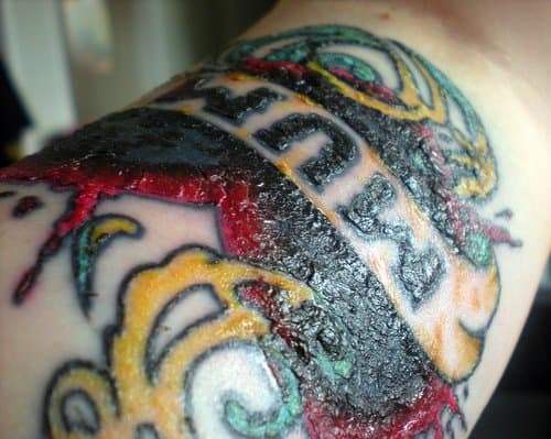 Tattoo Scabbing on new tattoo