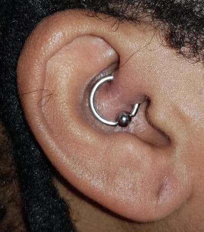 My daith piercing when it first started to become infected&mdash;you can see the skin is red and swollen.