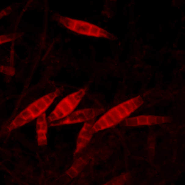 A Micrscopic Look at Ringworm - Owlcation