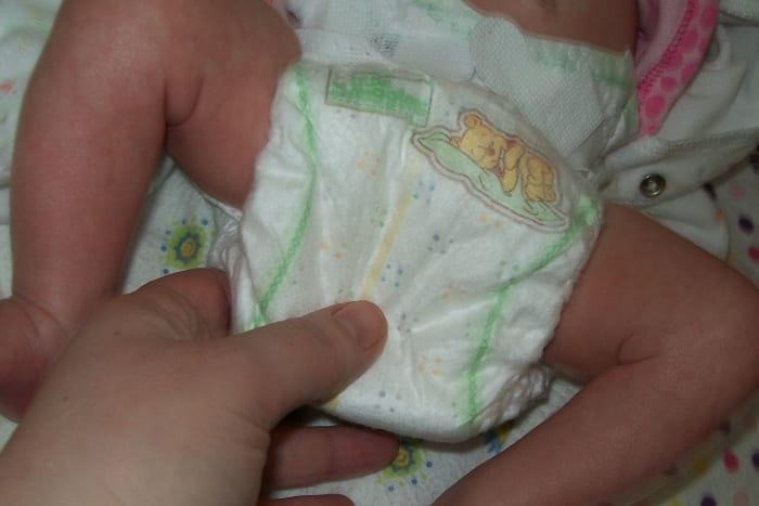 diapers with umbilical cord cut out