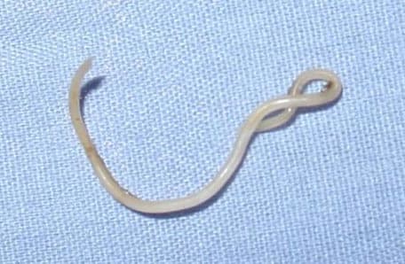 long flat intestinal worm