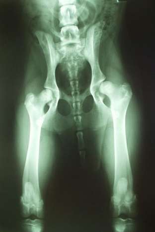 hip dysplasia natural treatment