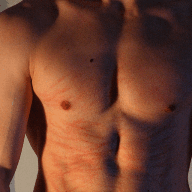 what-are-these-3-unexplained-scratches-on-my-body-with-photos