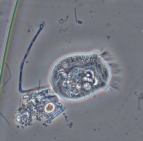 4 Main Groups of Protozoa - Owlcation - Education