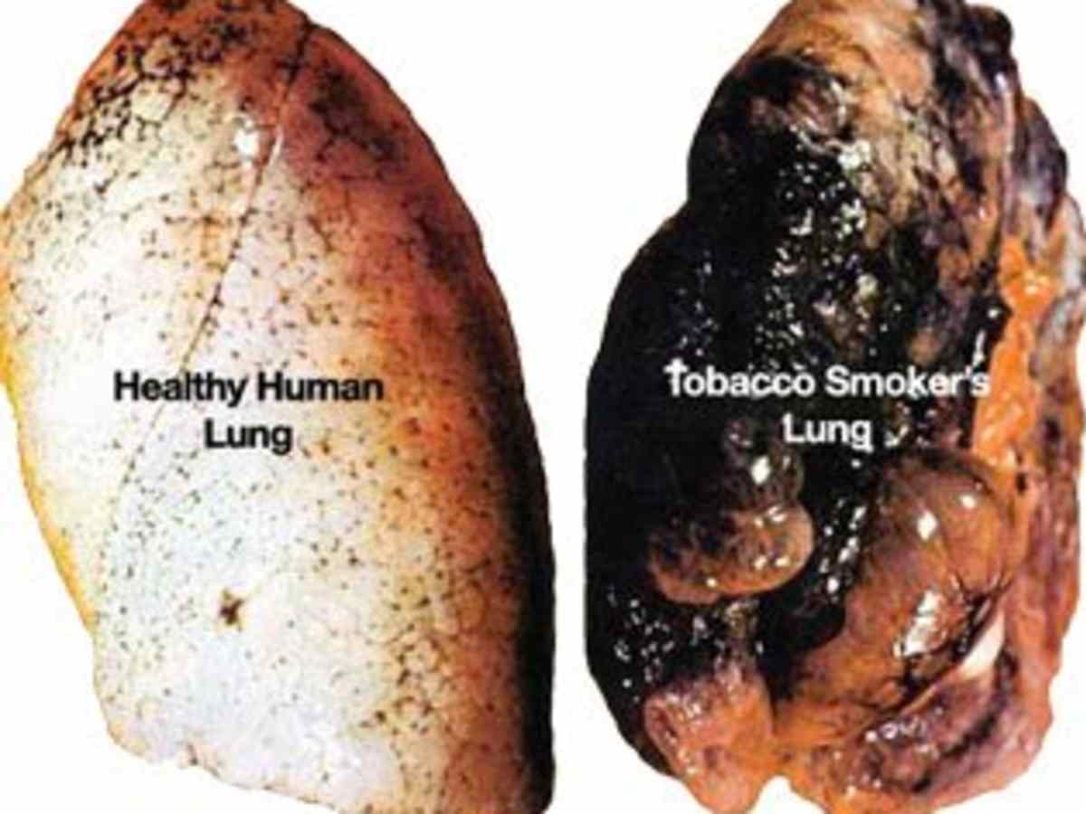 is sugar more dangerous than alcohol and tobacco Researchers: Sugar Kills Like Alcohol and Tobacco, Should be Regulated is sugar more dangerous than alcohol and tobacco Researchers: Sugar Kills Like Alcohol and Tobacco, Should be Regulated