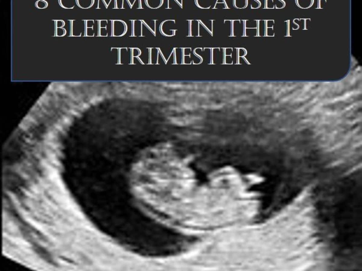 Ultrasound trimester normal first First Trimester