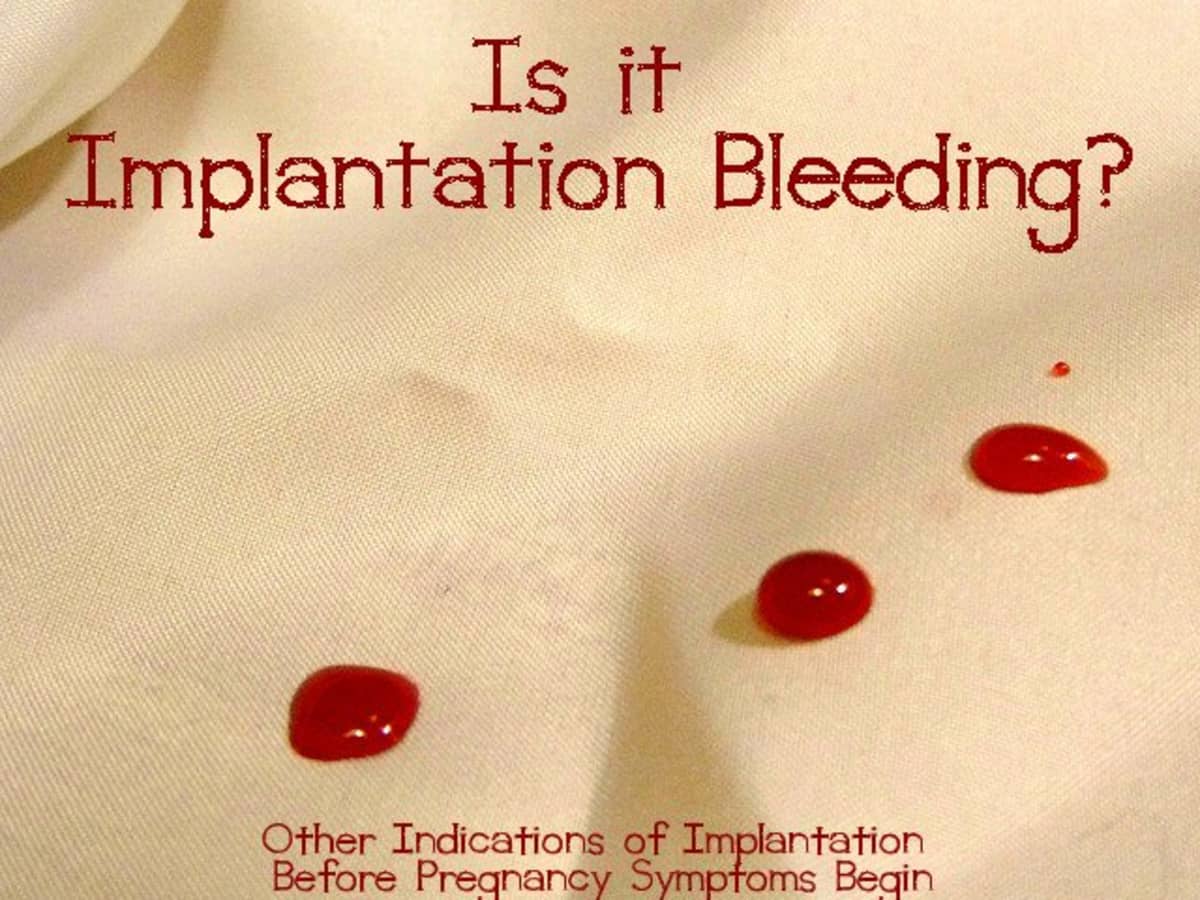 Implantation bleeding pregnancy Implantation Bleeding