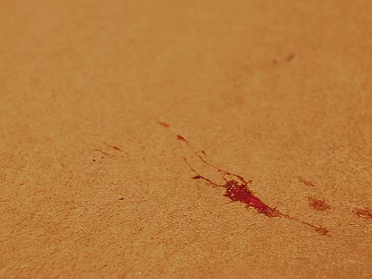 How to Remove Dried and Fresh Blood Stains - Dengarden