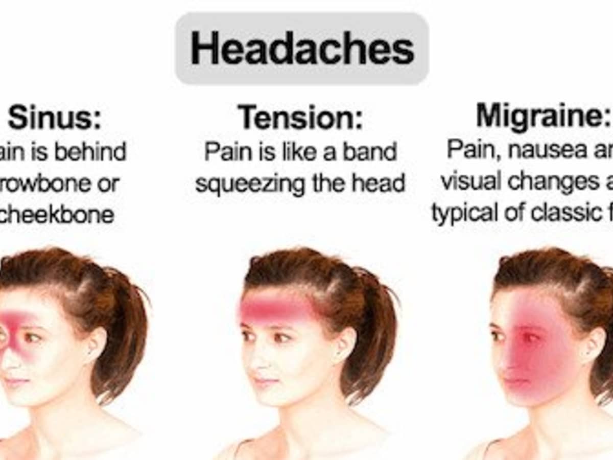 Headache In Back Of Head Location Causes And Treatment Hubpages