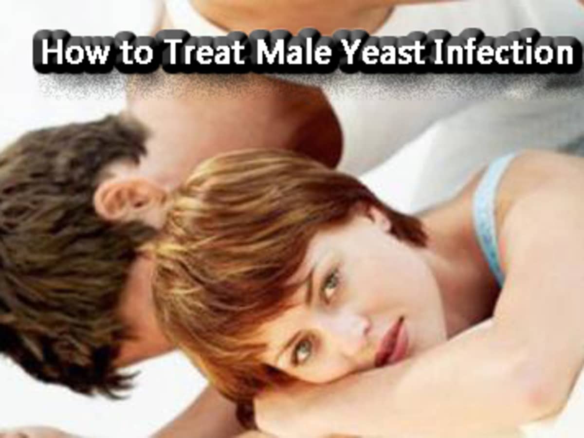 Can men get yeast infections? Male yeast infection treatments