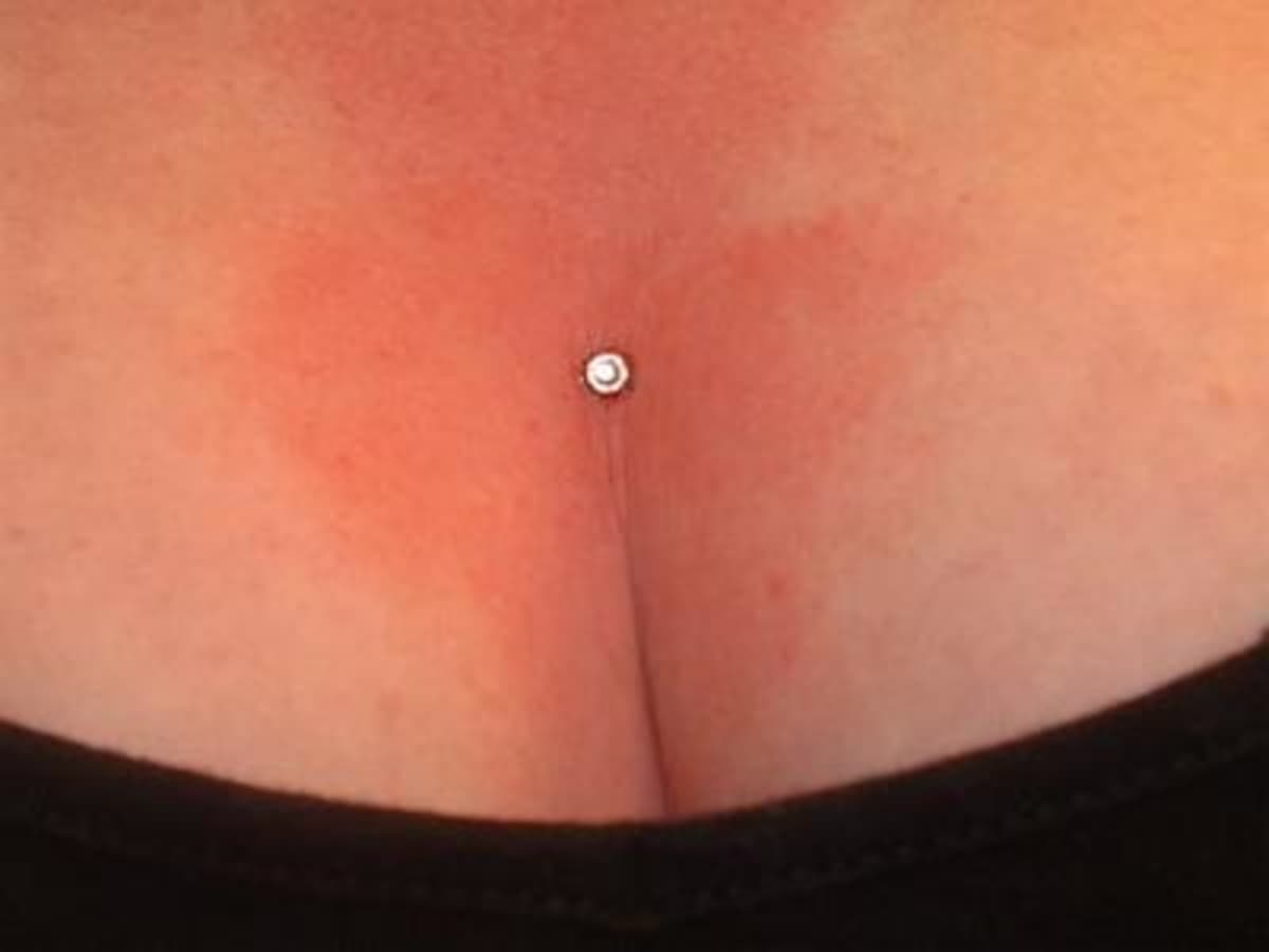 dermal piercing chest infection