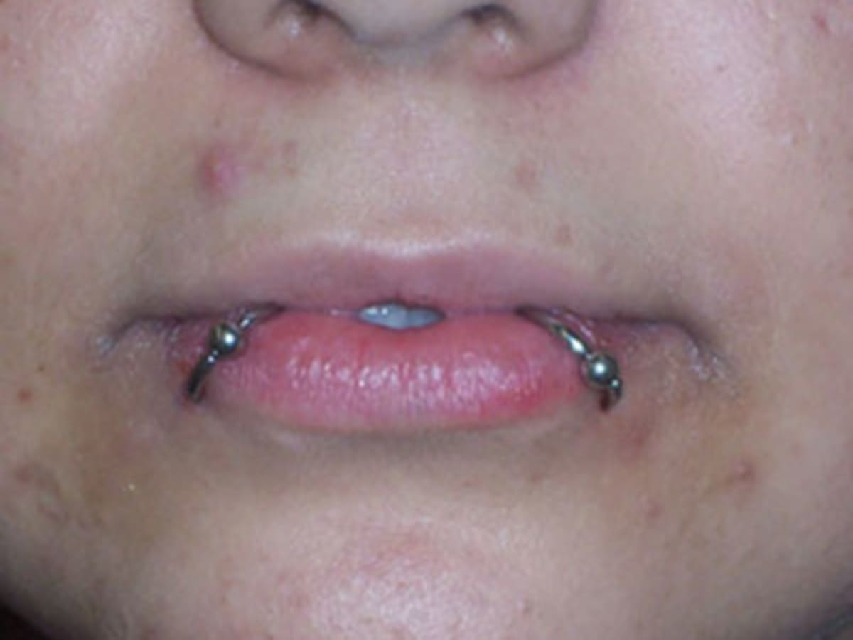 lip piercing snake bites