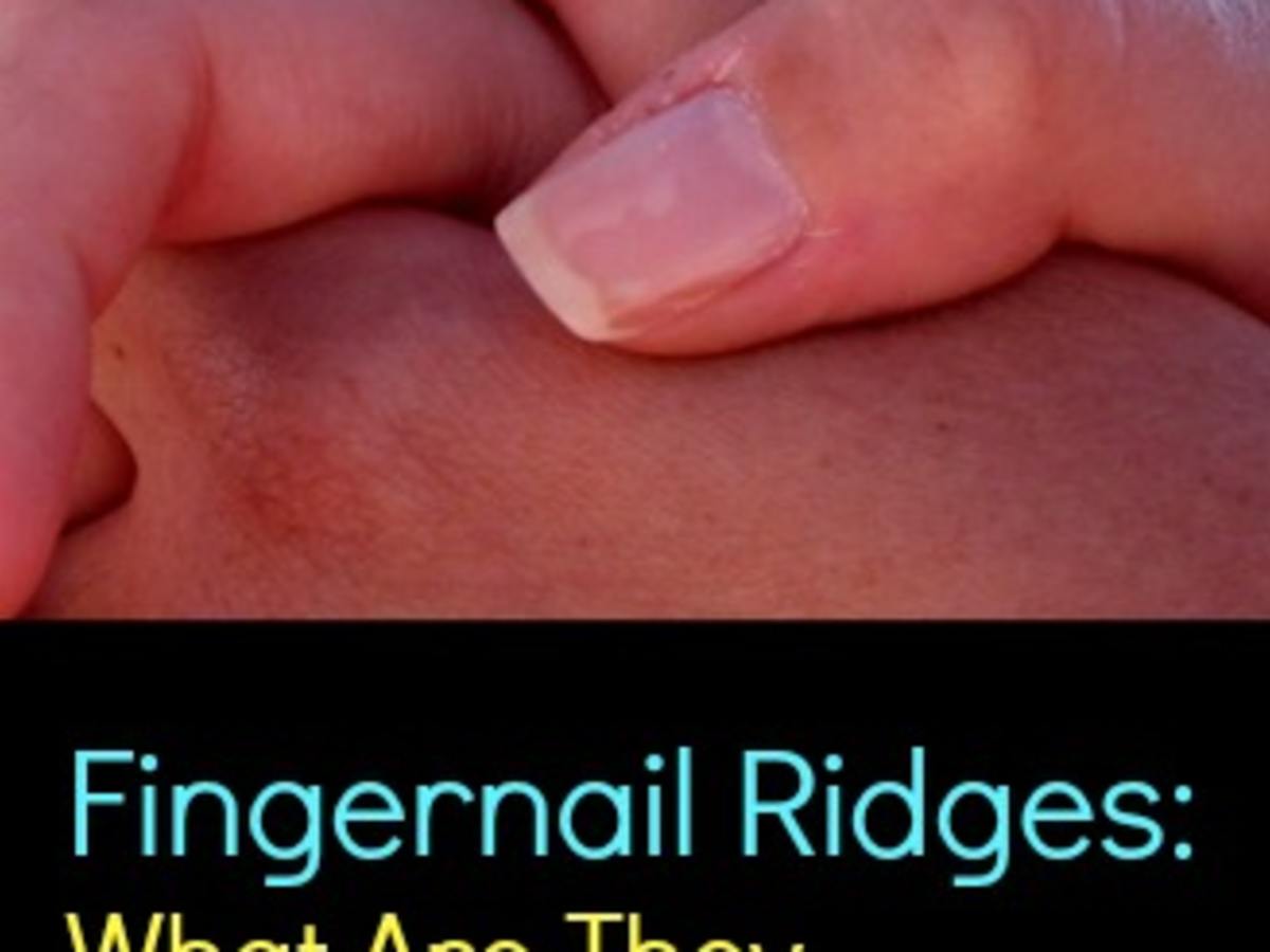 Treatment for Nail Ridges in Bangalore | Dr Tina Skin Solutionz