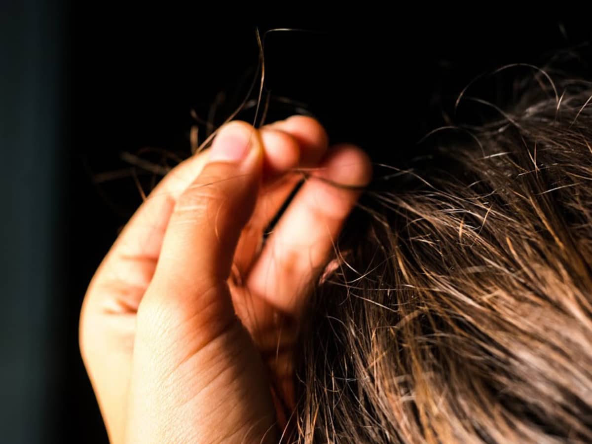 Trichotillomania (Hair-Pulling Disorder): What to Know