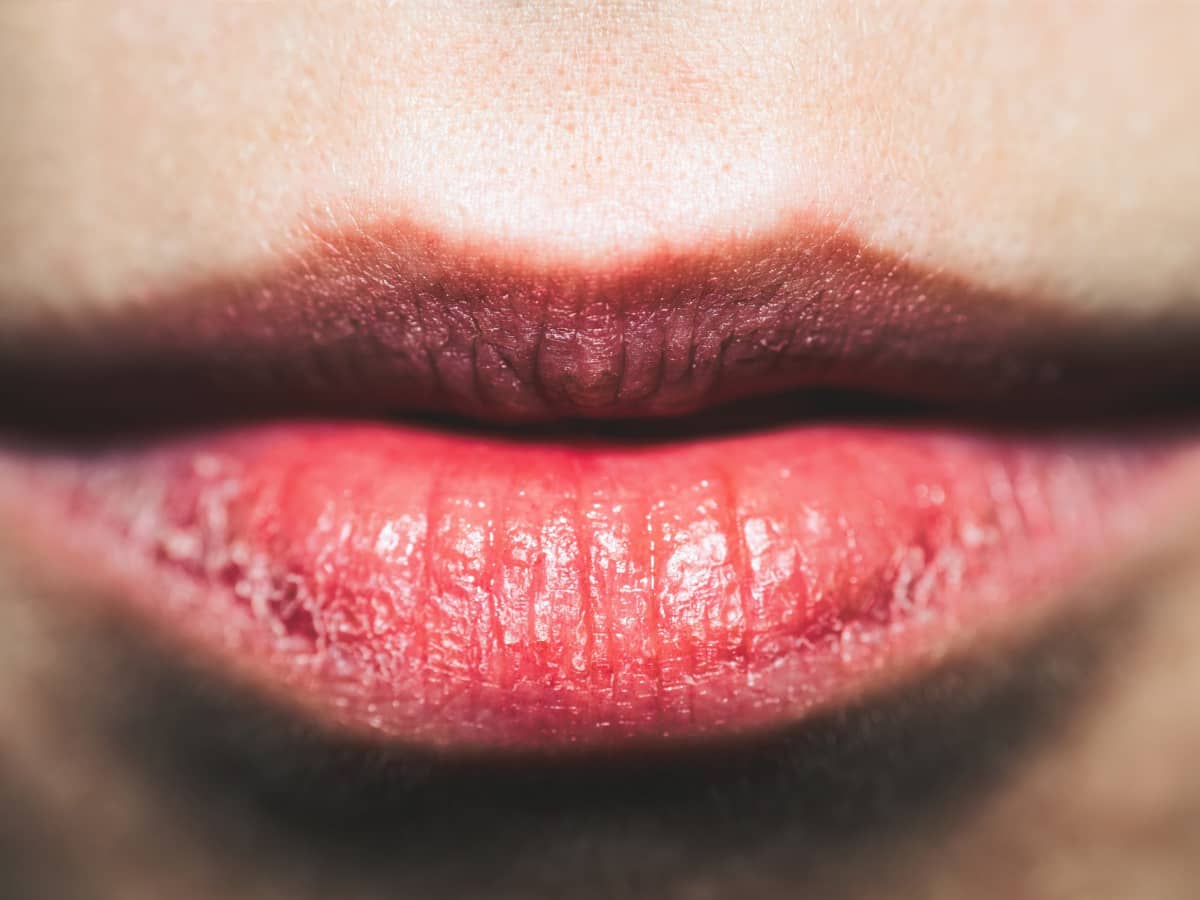 10 secrets to getting rid of dry skin on lips