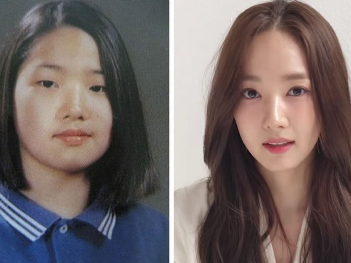 Famous Korean Celebrities Who Undergone Plastic Surgery Hubpages Fotoauflös...