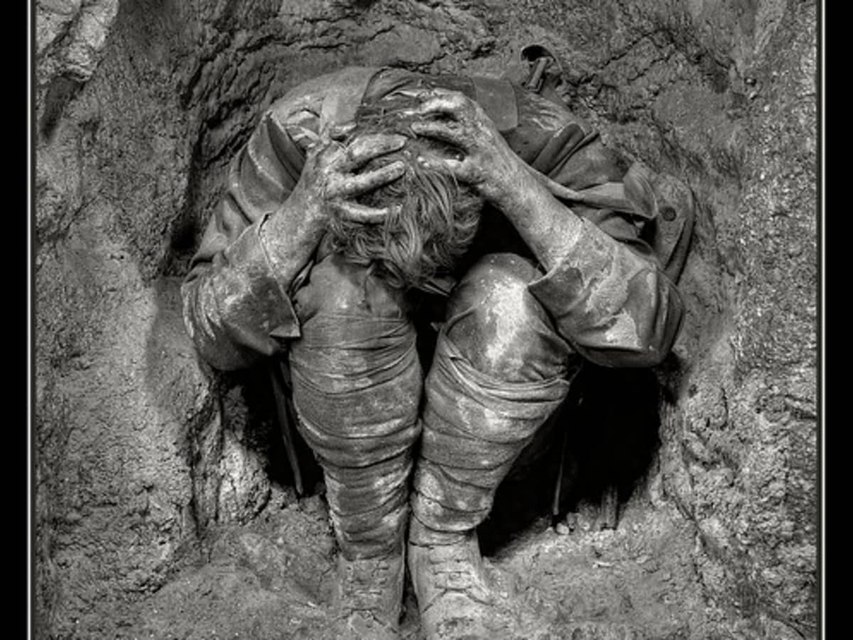 Believed to be photo of a shell shocked soldier during World War