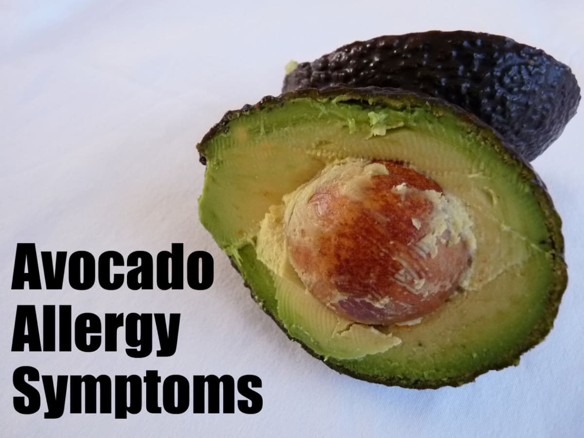 Avocado Allergy Symptoms Youmemindbody