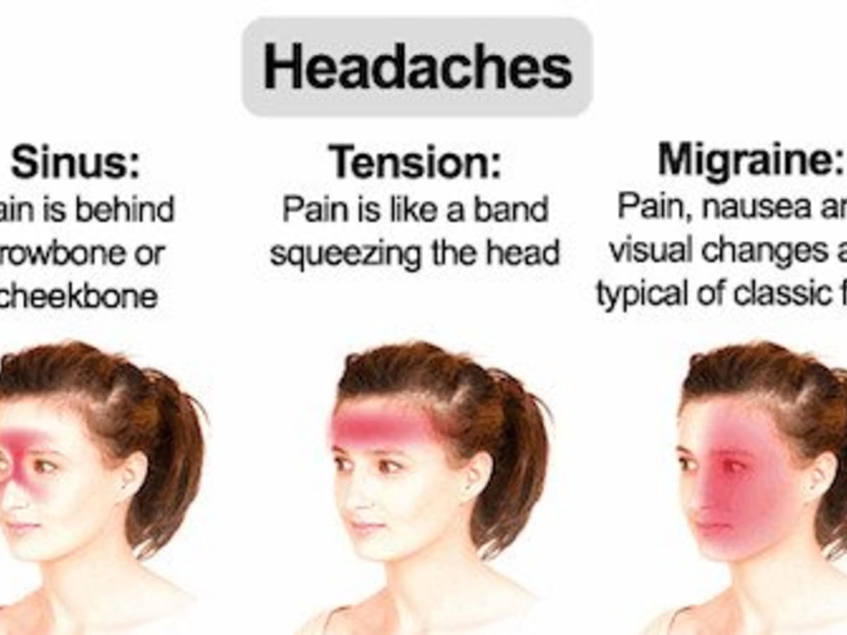 Headache In Back Of Head Location Causes And Treatment Hubpages