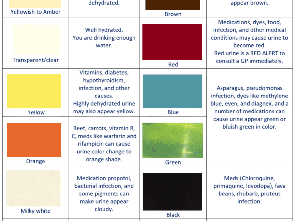 Urine Colors Chart : Food Can Change Urine Color - YouMeMindBody